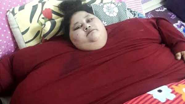 Une Égyptienne de 500 kg entame sa préparation chirurgicale