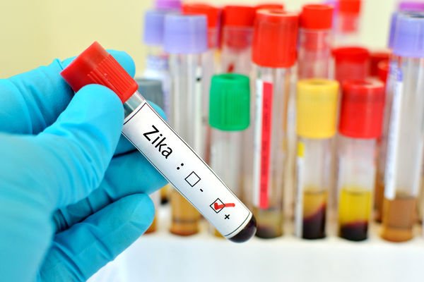 Virus Zika : Sanofi abandonne la recherche d’un vaccin